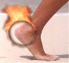 heel Pain